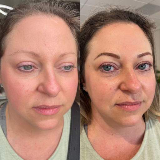 Combo Brow Correction: A skilled artist blending microblading and shading techniques to correct uneven or sparse eyebrows, resulting in a balanced and natural appearance.