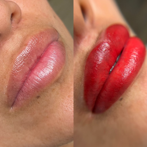 Lip Blush: A subtle, semi-permanent lip tint applied to enhance the natural color and shape of the lips, creating a fuller and more youthful appearance.