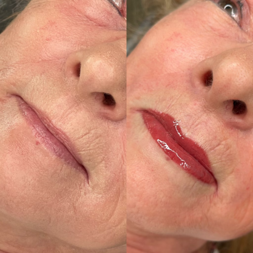 Lip Blush: A semi-permanent makeup technique that adds a soft, natural color to the lips, enhancing their shape and fullness.